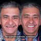Slider image (7) Odontologia Laser
